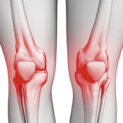 Diz Kireçlenmesi Ameliyatı Sonrası